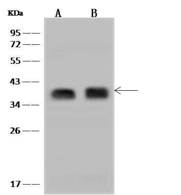 HCA59 Antibody [NBP3-06357] - Anti-HCA59 rabbit polyclonal antibody at 1:500 dilutionLane A: H1299 Whole Cell LysateLane B: HepG2 Whole Cell LysateLysates/proteins at 30 ug per lane.Secondary: Goat Anti-Rabbit IgG (H+L)/HRP at 1/10000 dilution.Developed using the ECL technique.Performed under reducing conditions.Predicted band size:34 kDa