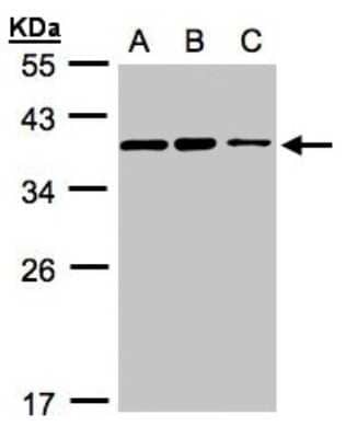 Western Blot: HCA59 Antibody [NBP1-32518] - Sample(30 ug whole cell lysate)A:H1299B:HeLa S3 C:Hep G2  12% SDS PAGE, antibody diluted at 1:3000.