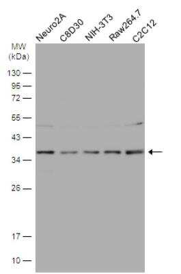 Western Blot: HCA59 Antibody [NBP1-32518] - Various whole cell extracts (30 ug) were separated by 12% SDS-PAGE, and the membrane was blotted with HCA59 antibody diluted at 1:500. HRP-conjugated anti-rabbit IgG antibody was used to detect the primary antibody.