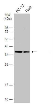 Western Blot: HCA59 Antibody [NBP1-32518] - Various whole cell extracts (30 ug) were separated by 12% SDS-PAGE, and the membrane was blotted with HCA59 antibody diluted at 1:500. HRP-conjugated anti-rabbit IgG antibody was used to detect the primary antibody.