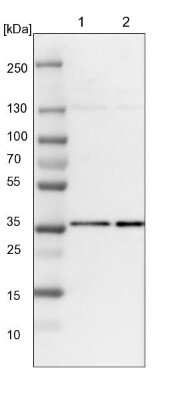 Western Blot: HCA59 Antibody [NBP1-83168] - Lane 1: NIH-3T3 cell lysate (Mouse embryonic fibroblast cells). Lane 2: NBT-II cell lysate (Rat Wistar bladder tumor cells).