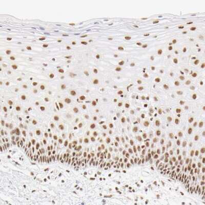 Immunohistochemistry-Paraffin: HCC1 Antibody [NBP1-88200] - Staining of human cervix, uterine shows moderate nuclear positivity in keratinocytes.