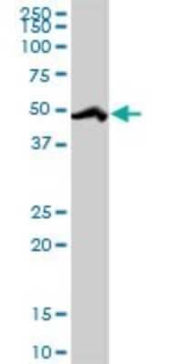 Western Blot: HCC1 Antibody [H00009584-D01P] - Analysis of RBM39 expression in human liver.