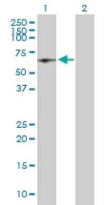 Western Blot: HCC1 Antibody [H00009584-D01P] - Analysis of RBM39 expression in transfected 293T cell line by RBM39 polyclonal antibody.Lane 1: RBM39 transfected lysate(58.70 KDa).Lane 2: Non-transfected lysate.