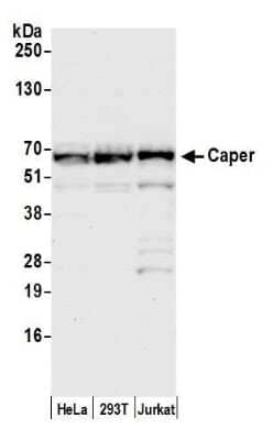 Western Blot HCC1 Antibody - BSA Free