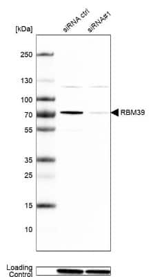 Knockdown Validated: HCC1 Antibody [NBP1-88200] - Analysis in Caco-2 cells transfected with control siRNA, target specific siRNA probe #1, using anti-RBM39 antibody. Remaining relative intensity is presented. Loading control: anti-GAPDH.