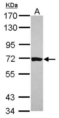 Western Blot: HCC1 Antibody [NBP2-16785] - Sample (30 ug of whole cell lysate) A: A431 7. 5% SDS PAGE gel, diluted at 1:1000.