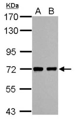 Western Blot: HCC1 Antibody [NBP2-16785] - Sample (30 ug of whole cell lysate) A: NIH-3T3 B: JC 7. 5% SDS PAGE gel, diluted at 1:1000.
