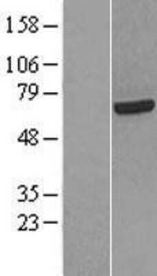 Western Blot: HCC1 Overexpression Lysate (Adult Normal) [NBL1-15210] Left-Empty vector transfected control cell lysate (HEK293 cell lysate); Right -Over-expression Lysate for HCC1.