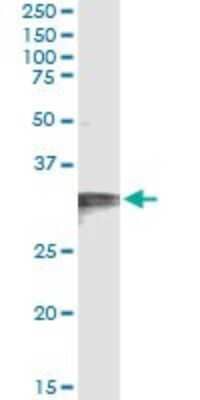 Immunoprecipitation: HCCS Antibody (3C7) [H00003052-M01] - Analysis of HCCS transfected lysate using anti-HCCS monoclonal antibody and Protein A Magnetic Bead, and immunoblotted with HCCS MaxPab rabbit polyclonal antibody.