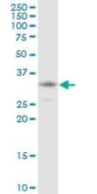 Western Blot: HCCS Antibody [H00003052-B01P] - Analysis of HCCS expression in HeLa.