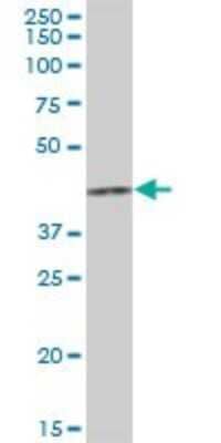 Western Blot: HCCS Antibody [H00003052-B01P] - Analysis of HCCS expression in human placenta.