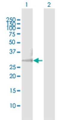 Western Blot: HCCS Antibody [H00003052-D01P] - Analysis of HCCS expression in transfected 293T cell line by HCCS polyclonal antibody.Lane 1: HCCS transfected lysate(30.60 KDa).Lane 2: Non-transfected lysate.