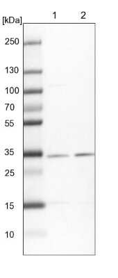 Western Blot: HCCS Antibody [NBP1-86577] - Lane 1: NIH-3T3 cell lysate (Mouse embryonic fibroblast cells). Lane 2: NBT-II cell lysate (Rat Wistar bladder tumor cells).