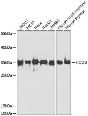 Western Blot: HCCS Antibody [NBP3-04609] - Analysis of extracts of various cell lines, using HCCS antibody at 1:1000 dilution. Secondary antibody: HRP Goat Anti-Rabbit IgG (H+L) at 1:10000 dilution. Lysates/proteins: 25ug per lane. Blocking buffer: 3% nonfat dry milk in TBST. Detection: ECL Basic Kit