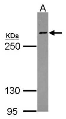 Western Blot: Host Cell Factor 1/HCFC1 Antibody [NBP2-16786] -  Sample (30 ug of whole cell lysate) A: HeLa 5% SDS PAGE gel, diluted at 1:500.