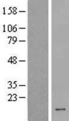 Western Blot: HCFC1R1 Overexpression Lysate (Adult Normal) [NBP2-08973] Left-Empty vector transfected control cell lysate (HEK293 cell lysate); Right -Over-expression Lysate for HCFC1R1.