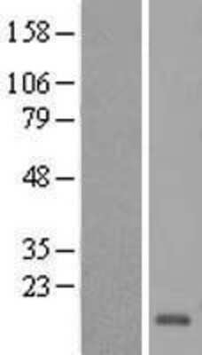 Western Blot: HCFC1R1 Overexpression Lysate (Adult Normal) [NBP2-09087] Left-Empty vector transfected control cell lysate (HEK293 cell lysate); Right -Over-expression Lysate for HCFC1R1.