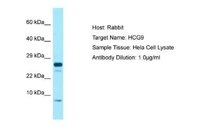 Western Blot: HCG IX Antibody [NBP1-98301] - Antibody Dilution: 1.0ug/ml Sample Tissue: Hela cell lysate.