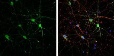 Immunocytochemistry/Immunofluorescence: HCN1 Antibody [NBP3-13014] - HCN1 antibody detects HCN1 protein by immunofluorescent analysis. Sample: DIV9 rat E18 primary cortical neuron cells were fixed in 4% paraformaldehyde at RT for 15 min. Green: HCN1 stained by HCN1 antibody (NBP3-13014) diluted at 1:500. Red: beta Tubulin 3/ Tuj1, stained by beta Tubulin 3/ Tuj1 antibody [GT1338] (NBP3-13505) diluted at 1:500. Blue: Fluoroshield with DAPI.