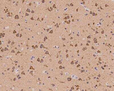 Immunohistochemistry-Paraffin: HCN1 Antibody [NBP3-12563] - Staining of human HCN1 in human brain with rabbit polyclonal antibody at 1:500 dilution.