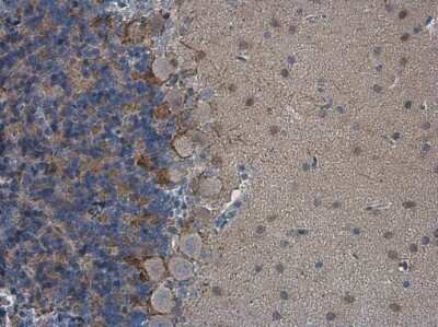 Immunohistochemistry-Paraffin: HCN1 Antibody [NBP3-13014] - HCN1 antibody detects HCN1 protein at cell membrane in rat brain by immunohistochemical analysis. Sample: Paraffin-embedded rat brain. HCN1 antibody (NBP3-13014) diluted at 1:500. Antigen Retrieval: Citrate buffer, pH 6.0, 15 min