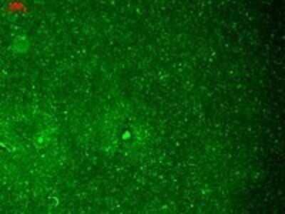 Immunohistochemistry: HCN1 Antibody (S70) [NBP1-22450] - Human Hippocampus