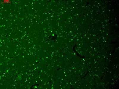 Immunohistochemistry: HCN1 Antibody (S70) [NBP1-22450] - Immunohistochemistry analysis using Mouse Anti-HCN1 Monoclonal Antibody, Clone S70 (NBP1-22450). Tissue: hippocampus. Species: Human. Fixation: Bouin's Fixative and paraffin-embedded. Primary Antibody: Mouse Anti-HCN1 Monoclonal Antibody (NBP1-22450) at 1:1000 for 1 hour at RT. Secondary Antibody: FITC Goat Anti-Mouse (green) at 1:50 for 1 hour at RT.