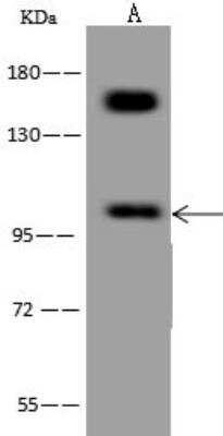 Western Blot: HCN1 Antibody [NBP3-12563] - Lane A: U-251 MG Whole Cell LysateLysates/proteins at 30 ug per lane.SecondaryGoat Anti-Rabbit IgG (H+L)/HRP at 1/10000 dilution.Developed using the ECL technique.Performed under reducing conditions.Predicted band size:99 kDaObserved band size:100 kDa(We are unsure as to the identity of these extra bands.)