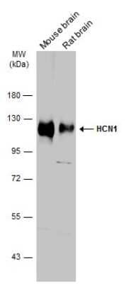 Western Blot: HCN1 Antibody [NBP3-13014] - Various tissue extracts (50 ug) were separated by 7.5% SDS-PAGE, and the membrane was blotted with HCN1 antibody (NBP3-13014) diluted at 1:1000. The HRP-conjugated anti-rabbit IgG antibody (NBP2-19301) was used to detect the primary antibody.