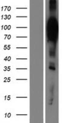 Western Blot: HCN2 Overexpression Lysate (Adult Normal) [NBP2-08224] Left-Empty vector transfected control cell lysate (HEK293 cell lysate); Right -Over-expression Lysate for HCN2.