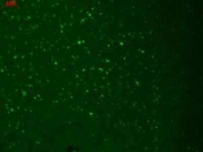 Immunohistochemistry-Paraffin: HCN3 Antibody (S141-28) [NBP2-12896] - Analysis of HCN3 in human hippocampal tissues using SMC-306. Courtesy of Dr. Turksen, Ottawa Hospital Research Institute, Canada.