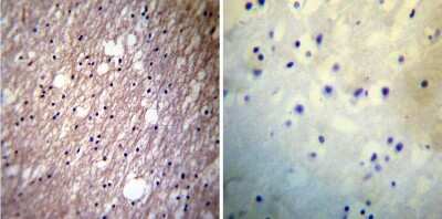 Immunohistochemistry-Paraffin: HCN3 Antibody (TLL6C5) [NB100-74438] - Both normal and cancer biopsies of deparaffinized Human brain tissues.
