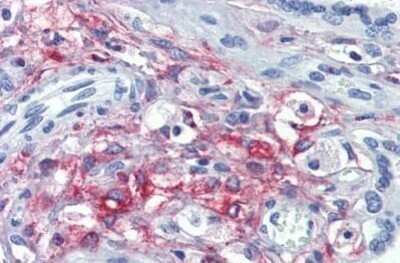 Immunohistochemistry-Paraffin: HCP1 Antibody [NBP1-52548] - Analysis of anti-SLC46A1 / HCP1 antibody with human placenta at concentration 3.75 ug/ml.