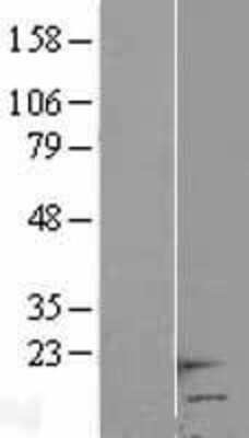 Western Blot: HCP5 Overexpression Lysate (Adult Normal) [NBL1-11472] Left-Empty vector transfected control cell lysate (HEK293 cell lysate); Right -Over-expression Lysate for HCP5.