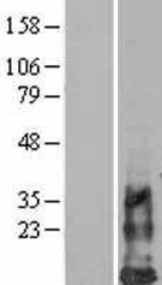 Western Blot: HCST Overexpression Lysate (Adult Normal) [NBL1-11475] Left-Empty vector transfected control cell lysate (HEK293 cell lysate); Right -Over-expression Lysate for HCST.