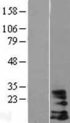 Western Blot: HCST Overexpression Lysate (Adult Normal) [NBL1-11476] Left-Empty vector transfected control cell lysate (HEK293 cell lysate); Right -Over-expression Lysate for HCST.