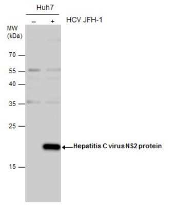 Western Blot: HCV-NS2 Antibody [NBP3-13042] - HCV-NS2 antibody detects HCV-NS2 by western blot analysis. Non-infected (-) and HCV JFH-1 strain-infected (+) Huh7 whole cell extracts (30 ug) were separated by 12% SDS-PAGE, and the membrane was blotted with HCV-NS2 antibody (NBP3-13042) diluted at 1:1000.