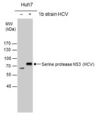 Western Blot: HCV-NS3 Antibody [NBP3-13009] - Serine protease NS3(HCV virus) antibody detects Serine protease NS3 protein by western blot analysis. Non-transfected (-) and Serine protease NS3-transfected (+) Huh7 whole cell extracts (30ug) were separated by 7.5% SDS-PAGE, and the membrane was blotted with Serine protease NS3(HCV virus) antibody (NBP3-13009) at a dilution of 1:2000