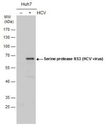 Western Blot: HCV-NS3 Antibody [NBP3-13009] - Serine protease NS3 (HCV virus) antibody detects Serine protease NS3 (HCV virus) protein by western blot analysis. Un-infected (-) and infected (+, HCV infection for ) Huh7 whole cell extracts (20 ug) were separated by 10% SDS-PAGE, and the membrane was blotted with Serine protease NS3 (HCV virus) antibody (NBP3-13009) diluted by 1:1000.