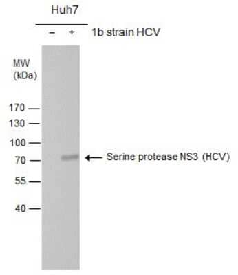 Western Blot: HCV-NS3 Antibody [NBP3-13013] - Serine protease NS3(HCV virus) antibody detects Serine protease NS3 protein by western blot analysis. Non-transfected (-) and Serine protease NS3-transfected (+) Huh7 whole cell extracts (30ug) were separated by 7.5% SDS-PAGE, and the membrane was blotted with Serine protease NS3(HCV virus) antibody (NBP3-13013) at a dilution of 1:1000