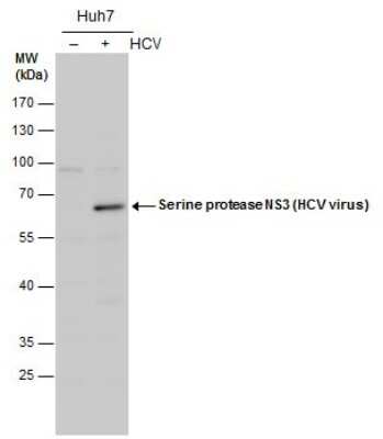 Western Blot: HCV-NS3 Antibody [NBP3-13013] - Serine protease NS3 (HCV virus) antibody detects Serine protease NS3 (HCV virus) protein by western blot analysis. Un-infected (-) and infected (+, HCV infection for ) Huh7 whole cell extracts (20 ug) were separated by 10% SDS-PAGE, and the membrane was blotted with Serine protease NS3 (HCV virus) antibody (NBP3-13013) diluted by 1:1000.