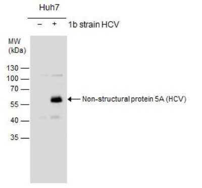 Western Blot: HCV-NS5a Antibody [NBP3-13010] - Non-structural protein 5A(HCV virus) antibody detects Non-structural protein 5A protein by western blot analysis. Non-transfected (-) and Non-structural protein 5A-transfected (+) Huh7 whole cell extracts (30ug) were separated by 10% SDS-PAGE, and the membrane was blotted with Non-structural protein 5A(HCV virus) antibody (NBP3-13010) at a dilution of 1:5000