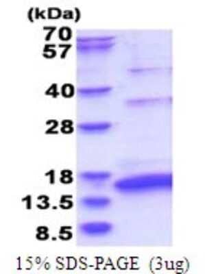 SDS-Page: HCV-NS5a Recombinant Protein [NBP2-51751] - 15% SDS Page (3 ug)