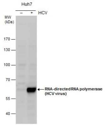 Western Blot: HCV-NS5b Antibody [NBP3-13011] - RNA-directed RNA polymerase (HCV virus) antibody detects RNA-directed RNA polymerase (HCV virus) protein by western blot analysis. Un-infected (-) and infected (+, HCV infection for ) whole cell extracts (30 ug) were separated by 7.5% SDS-PAGE, and the membrane was blotted with RNA-directed RNA polymerase (HCV virus) antibody (NBP3-13011) at a dilution of 1:1000.