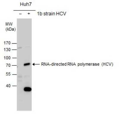 Western Blot: HCV-NS5b Antibody [NBP3-13011] - RNA-directed RNA polymerase(HCV virus) antibody detects RNA-directed RNA polymerase protein by western blot analysis. Non-transfected (-) and RNA-directed RNA polymerase-transfected (+) Huh7 whole cell extracts (30ug) were separated by 7.5% SDS-PAGE, and the membrane was blotted with RNA-directed RNA polymerase(HCV virus) antibody (NBP3-13011) at a dilution of 1:2000