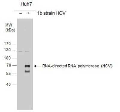 Western Blot: HCV-NS5b Antibody [NBP3-13012] - RNA-directed RNA polymerase(HCV virus) antibody detects RNA-directed RNA polymerase protein by western blot analysis. Non-transfected (-) and RNA-directed RNA polymerase-transfected (+) Huh7 whole cell extracts (30ug) were separated by 7.5% SDS-PAGE, and the membrane was blotted with RNA-directed RNA polymerase(HCV virus) antibody (NBP3-13012) at a dilution of 1:1000