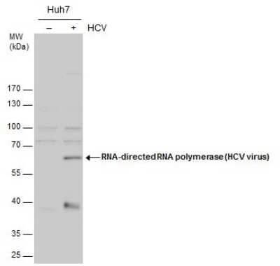 Western Blot: HCV-NS5b Antibody [NBP3-13012] - RNA-directed RNA polymerase (HCV virus) antibody detects RNA-directed RNA polymerase (HCV virus) protein by western blot analysis. Un-infected (-) and infected (+, HCV infection for ) Huh7 whole cell extracts (20 ug) were separated by 10% SDS-PAGE, and the membrane was blotted with RNA-directed RNA polymerase (HCV virus) antibody (NBP3-13012) diluted by 1:1000.