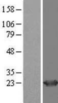 Western Blot HD domain containing 2 Overexpression Lysate