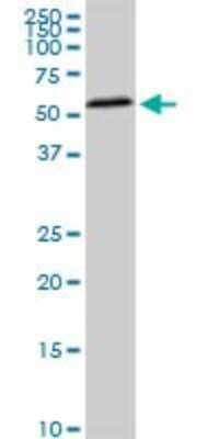 Western Blot: HDAC1 Antibody (3E1) [H00003065-M02] - HDAC1 monoclonal antibody (M02), clone 3E1. Analysis of HDAC1 expression in PC-12.